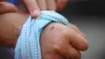 dog bite claims
