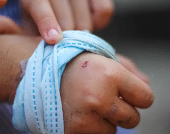 dog bite claims